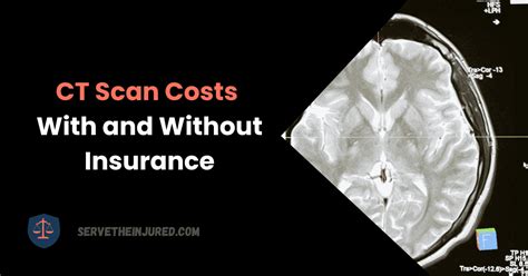 The Villages, FL CT Scan Cost Average .